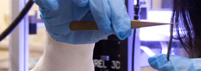 Hands of Mounika Kakarla holding a medical device.